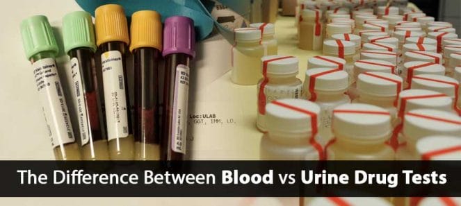 Blood vs Urine Drug Tests