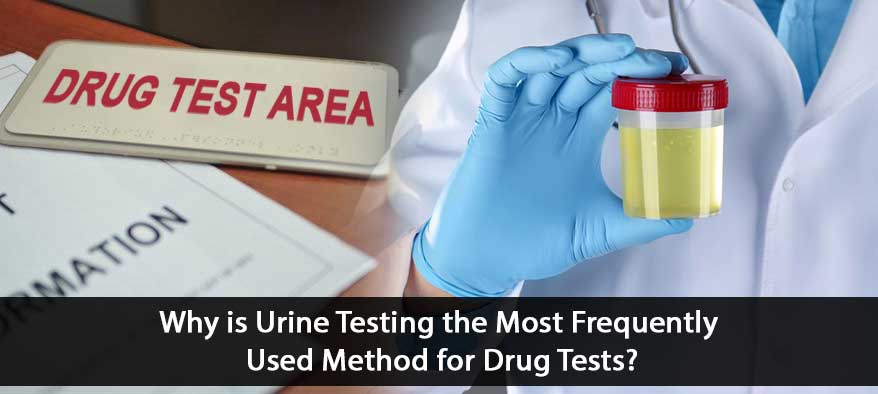 pee sample for drug test
