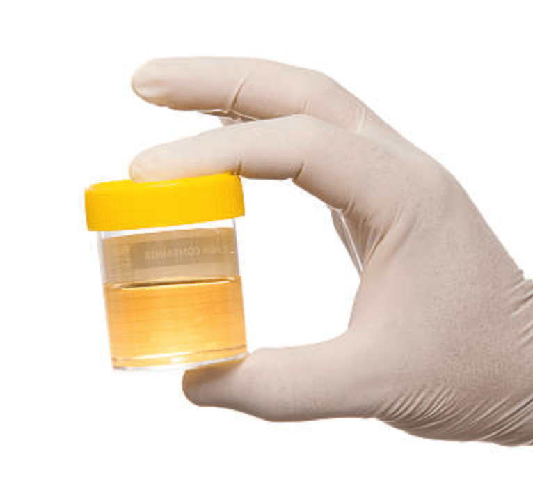 urine sample