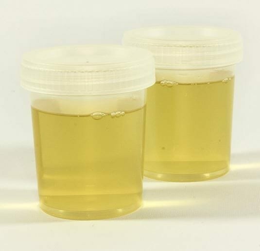 urine samples