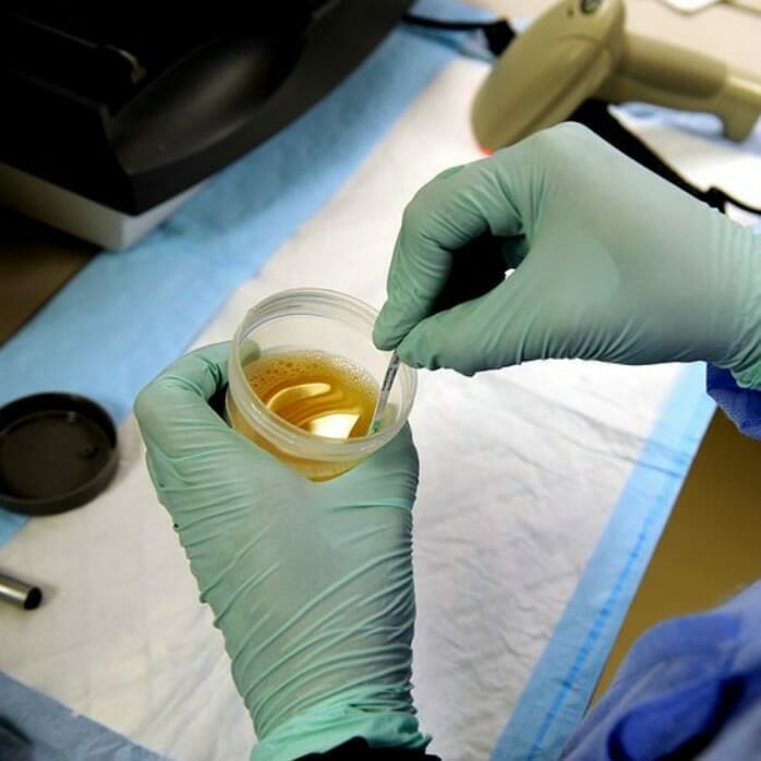 pee sample for drug test