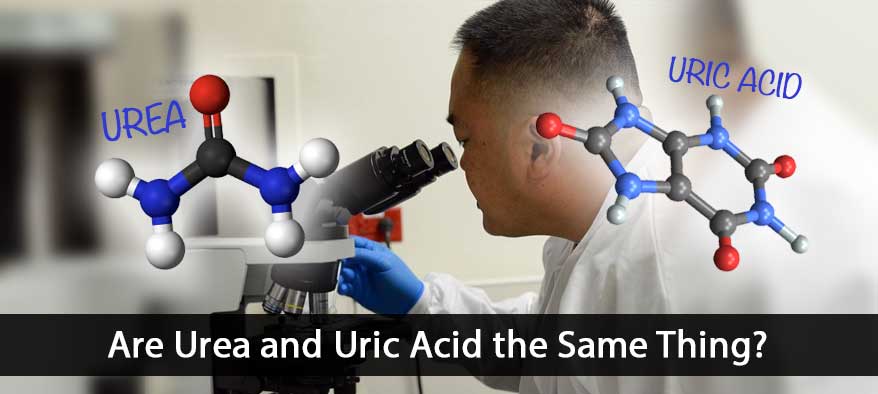 Uric Acid and Urea