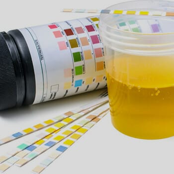 Urine Test Strips