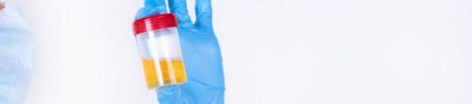 A nurse raising up a urine sample with gloves on
