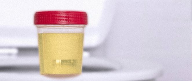 A synthetic urine on a toilet 
