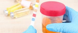 Drug Screening Vs Drug Testing<br> Differences, Similarities, and Purposes