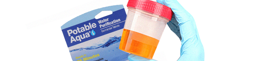 A urine sample in a container being held by a hand