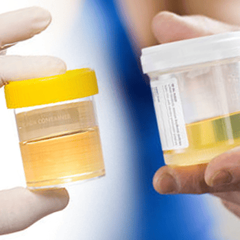 Comparison between fake and real urine 