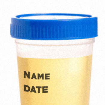 Real urine sealed inside a container