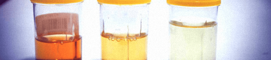 Different kinds of urine in an airtight lid for drug testing