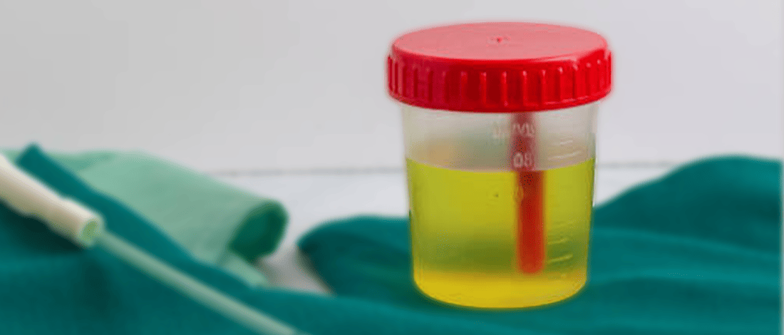 6 Best Ways to Store Urine for a Drug Test A Complete Guide Urine in a sealed container