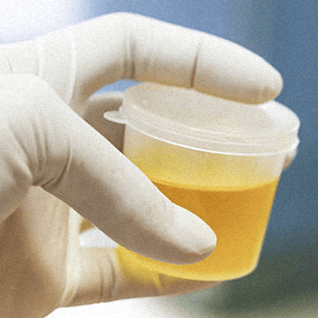 Synthetic urine being held by a person with protective gloves