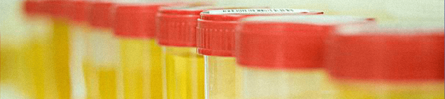 Urine samples in a straight line