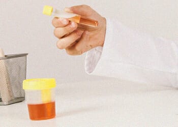 Synthetic urine being reused in another container