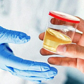 A urine sample given to a professional