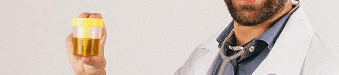 A man holding a urine sample