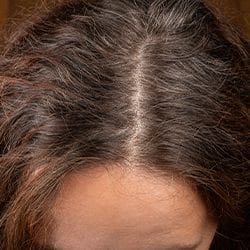 A woman's hair roots 