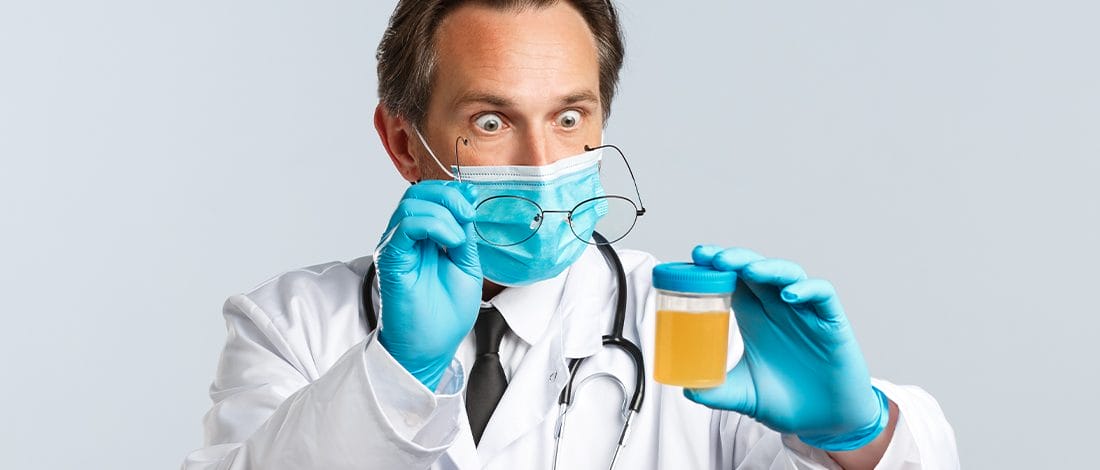 Does Petsmart Drug Test for Employment? What You Should Know Shocked doctor looking at a urine sample