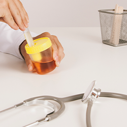 A doctor examining a urine sample