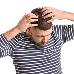 man showing his hair