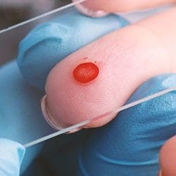 A person getting a blood test