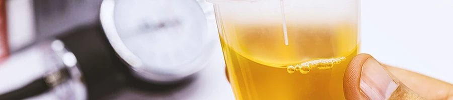 A person holding a urine sample