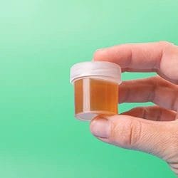 A person holding a small urine sample