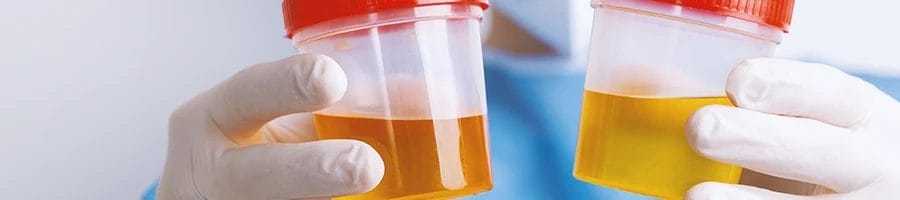 A scientist looking at two samples of urine