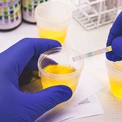 A scientist testing urine samples