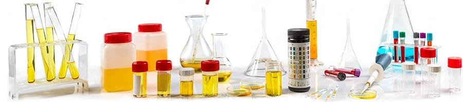 Different laboratory equipment and containers filled with urine