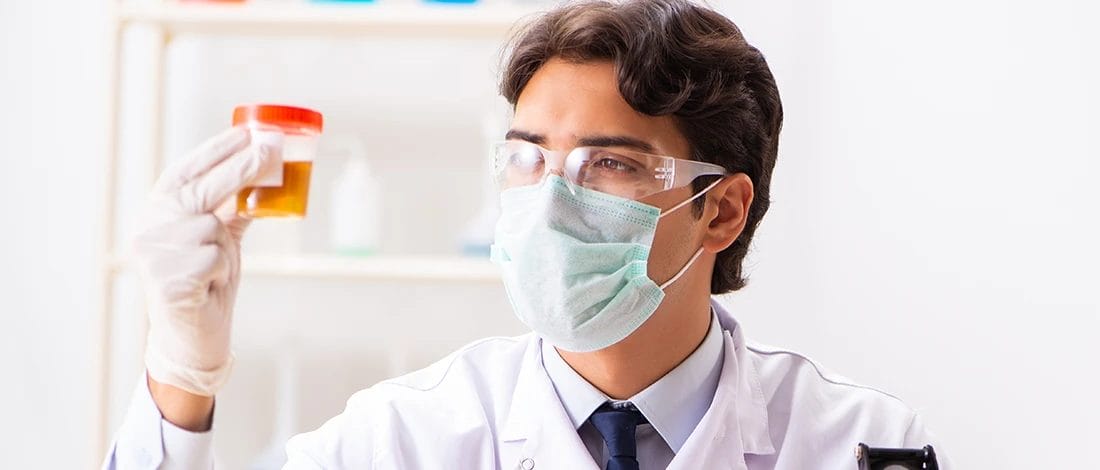 Does Synthetic Urine Work For eScreen? (What to Expect) A doctor inspecting a jar of urine