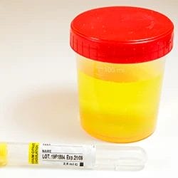 A jar full of urine ready for drug test