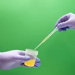 An image of a person getting a sample of urine from a jar