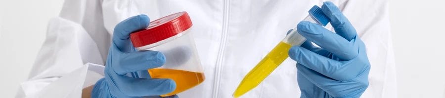 A person holding a real urine and synthetic urine
