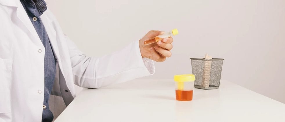 A doctor holding a sample of urine on a desk