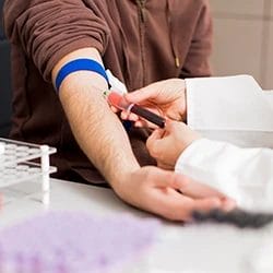 An image of a doctor getting blood sample for TCA screen
