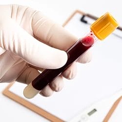 A close up image of a doctor holding a blood sample