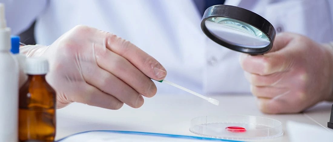 A doctor checking a blood sample if TCA is present