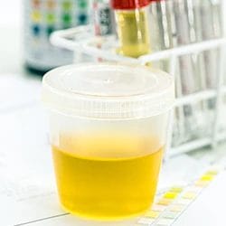 A close up image of a container filled with urine and other testing materials at the back