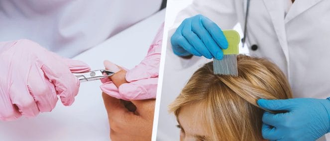 Fingernail Drug Testing and Hair Follicle Drug Testing in a hospital side by side