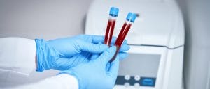 Do Drugs Show Up in Blood Tests? (6 Detection Factors)