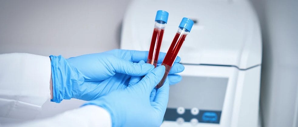 A person holding two test tubes filled with blood for blood testing