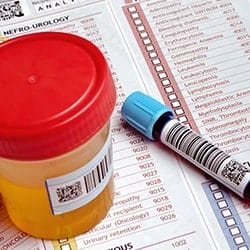 Blood and urine sample for drug testing