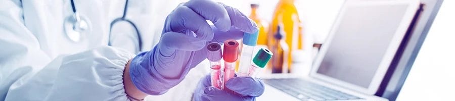 A doctor holding different test tubes for pre-employment drug testing