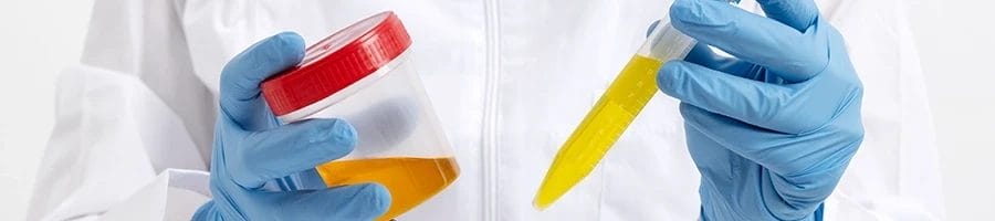 Doctor holding a jar of urine for drug testing