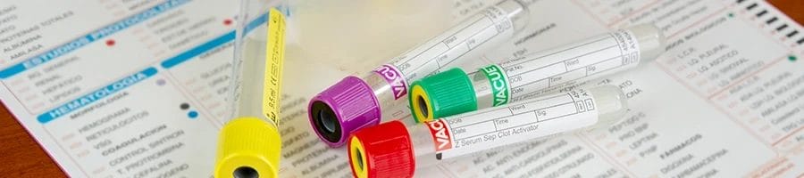 A close up shot of test tubes for drug screening