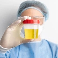 A doctor holding a jar of urine for urinalysis screening