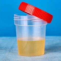 A jar with urine ready for drug testing