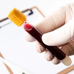 A close up shot of a hand holding a test tube of blood ready for blood drug testing