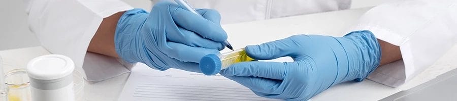 A doctor holding a urine sample for pre-employment drug test